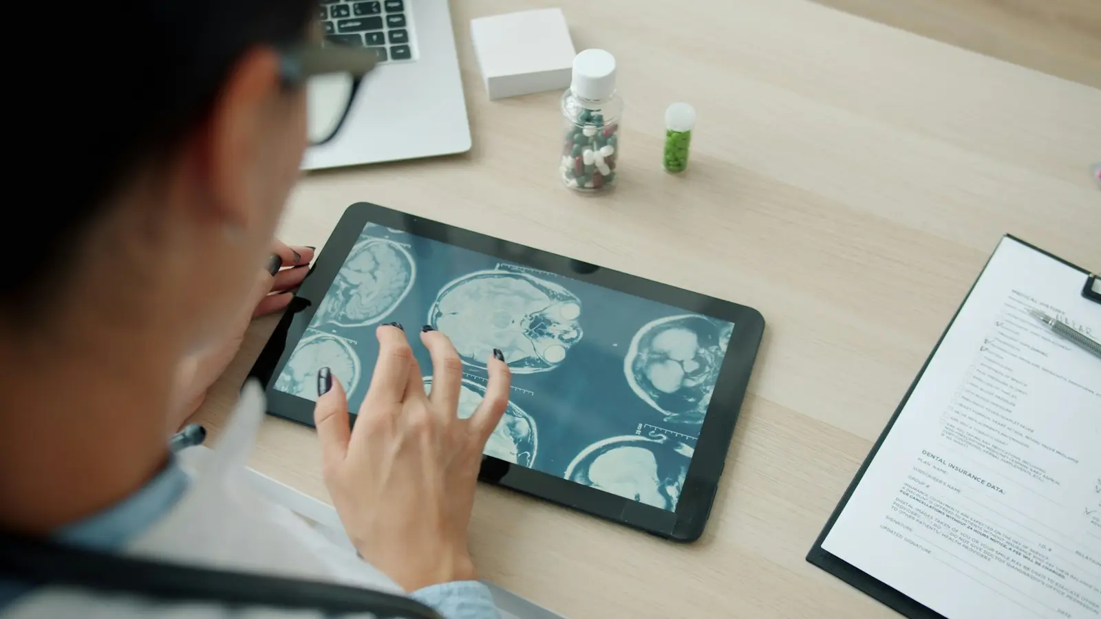 Pessoa analisando imagens de exame em um tablet sobre a mesa.